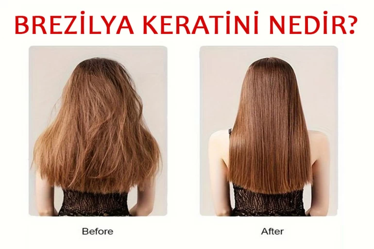 Brezilya Keratini Nedir?